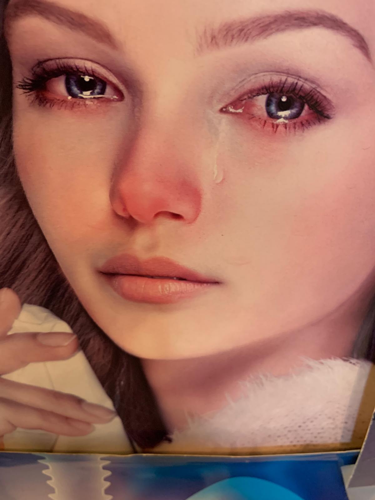 Rinitis alérgica con gran congestión nasal,lagrimeo,estornudos, Mucosidad cristalina, comezón en nariz y ojos, dolor de cabeza ///allergic rhinitis with severe congestion nasal, Watery eyes,sneezing,clear mucus,itching in the nose and eyes and headache.